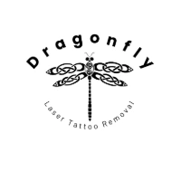 Dragonfly Laser Tattoo Removal